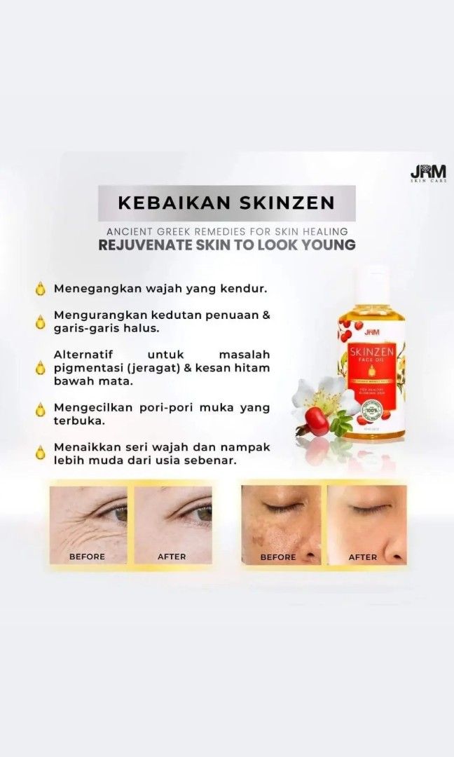 SKINZEN Face Oil buy 2 get 1 FREE (Category: Face Care) located in Singapore. Submitted by idnor (Listing ID 1282972257, Image 2). Description: Skinzen Face Oil Newest Face Oil From HOLOSTIC JRM •Fastly slackening and old face •Shrink face pores •Raises face series and looks younger than actual age •Skin is shinier and healthier •Moisturizes and Controls facial oil •Activates lymphatic nerves •Suitable for sensitive skin and ekzema We are selling