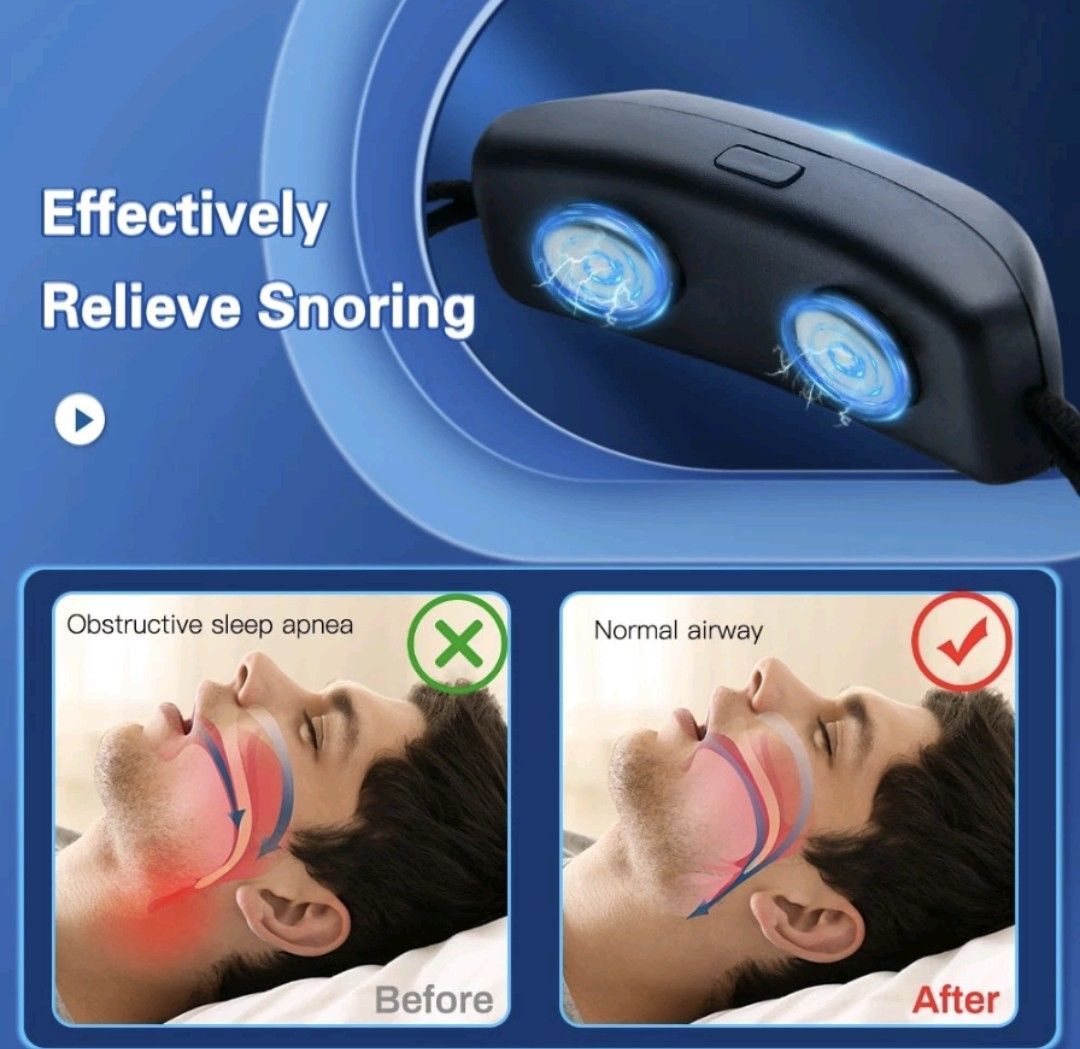 Smart Anti Snoring Device EMS Pulse Stop Snore Improve Sleeping Wrist Chin Strap Aid Effective Solution Snore Portable Noise Reduction Stimulator (Category: Wearables & Smart Watches) located in Singapore. Submitted by designtots (Listing ID 1298265142, Image 3). Description: Smart Anti Snoring Device EMS Pulse Stop Snore Improve Sleeping Wrist Chin Strap Aid Effective Solution Snore Portable Noise Reduction Stimulator Describe: Black colour Mate
